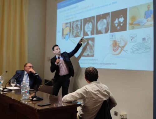 El uso de la Inteligencia Artificial hace más preciso el diagnóstico y tratamiento del cáncer de próstata